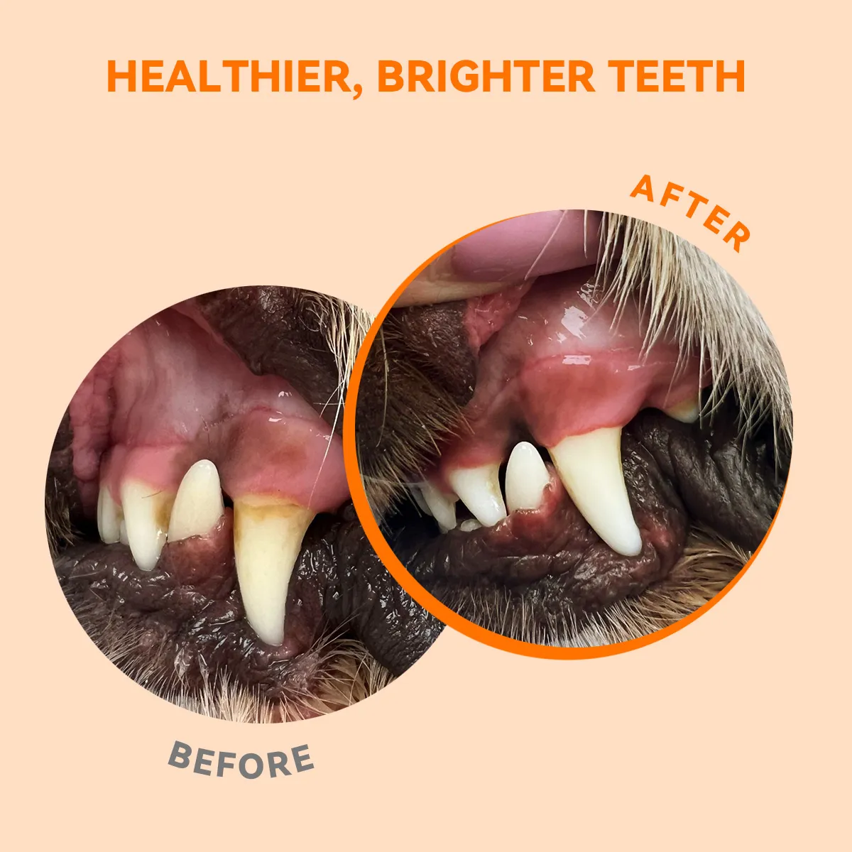 Brighter Teeth
